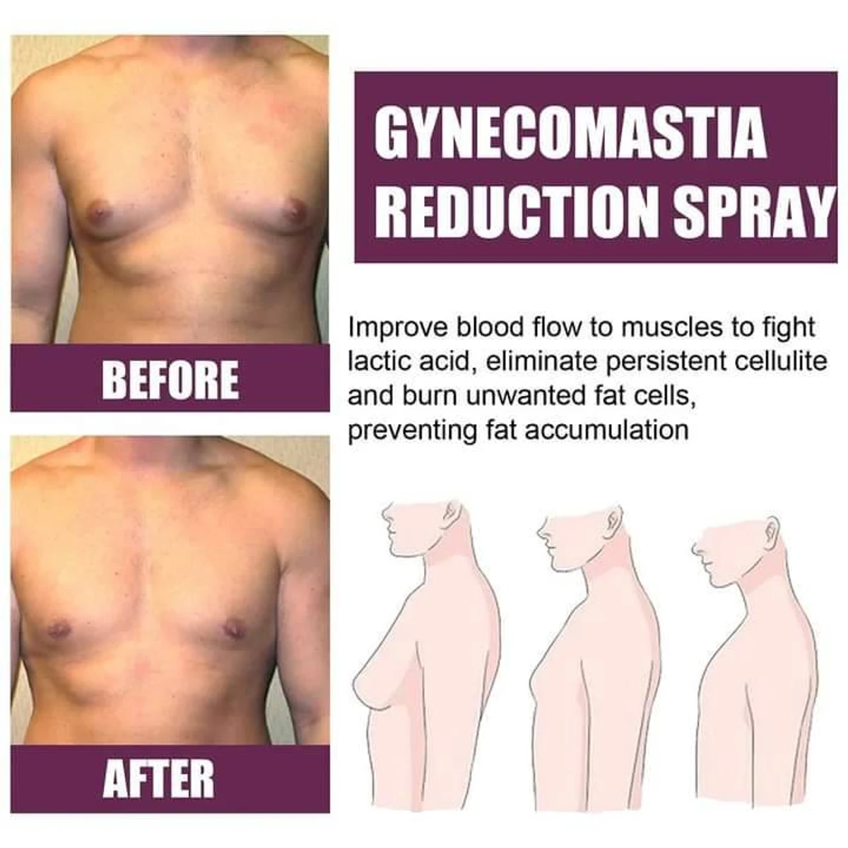Gynecomastia Reduction Spray_Weight Loss